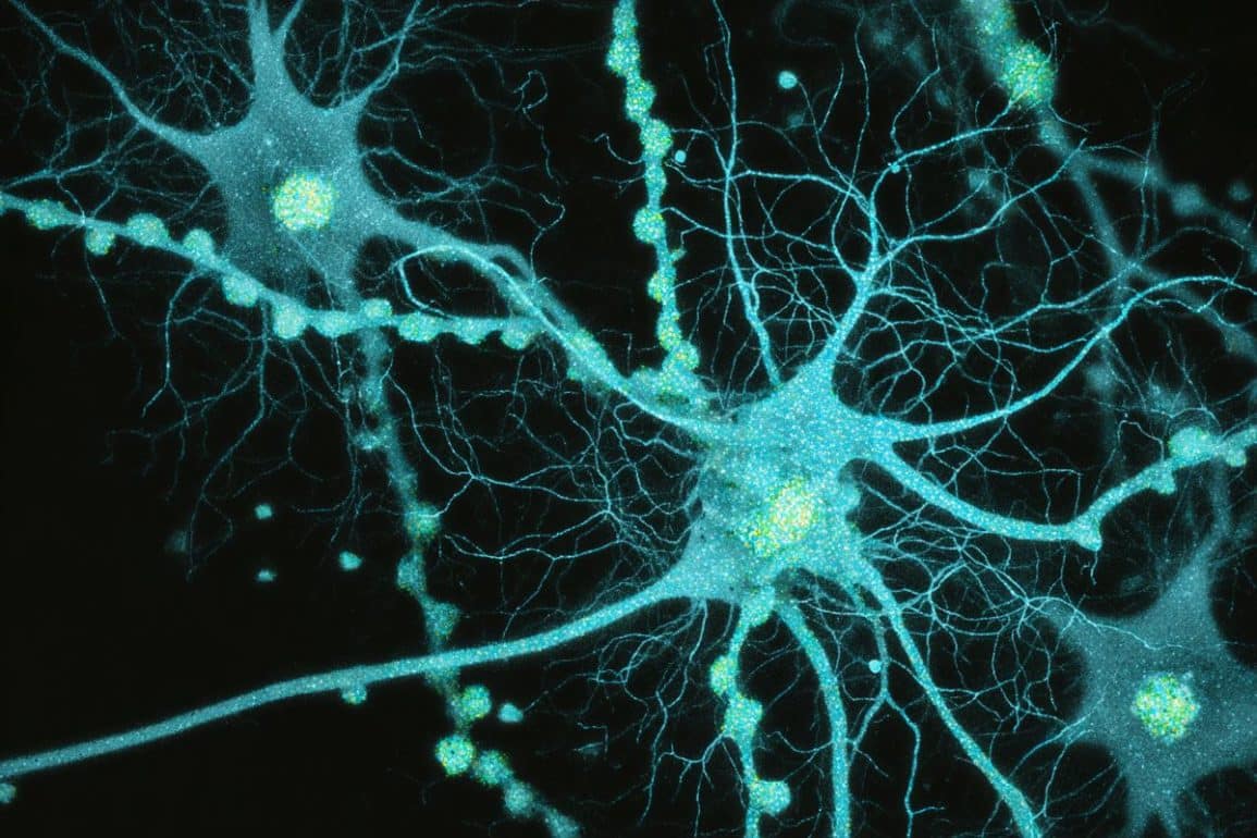 This shows hippocampal neurons, and is an AI representation.