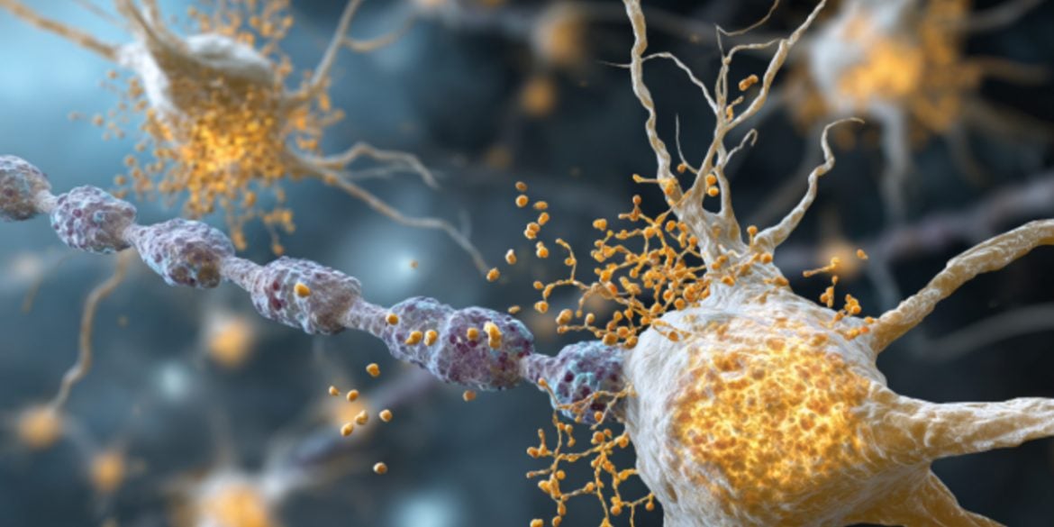 This shows healthy microglia and neurons.