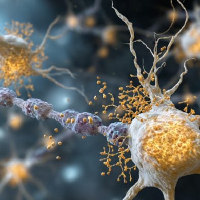 This shows healthy microglia and neurons.