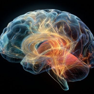 This shows a brain.