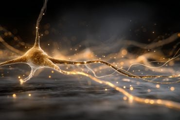 This shows a neuron.