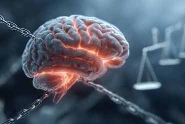 This shows a brain surrounded by chains.