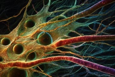 This shows neurons in the retina.