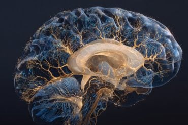 This shows a brain.