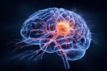 This shows a brain with an overlay of cancer cells.
