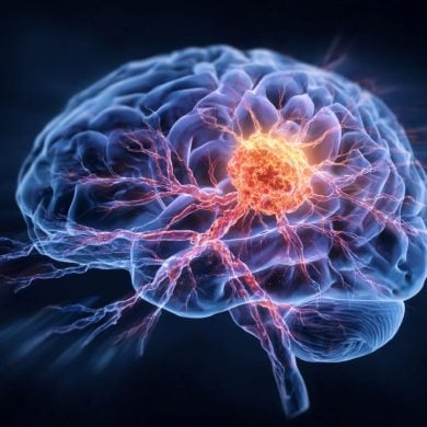 This shows a brain with an overlay of cancer cells.
