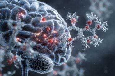 This shows a brain and cancer cells.