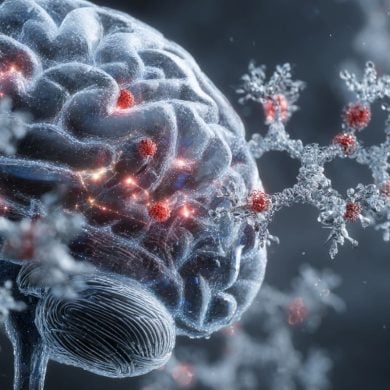 This shows a brain and cancer cells.