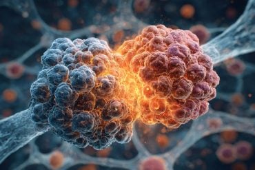 This shows cancer cells.