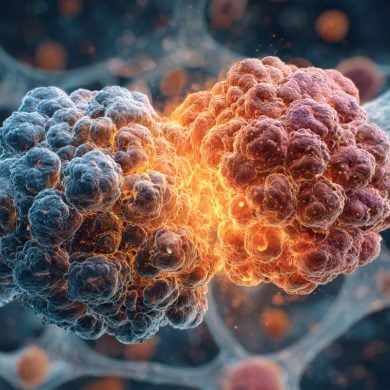 This shows cancer cells.