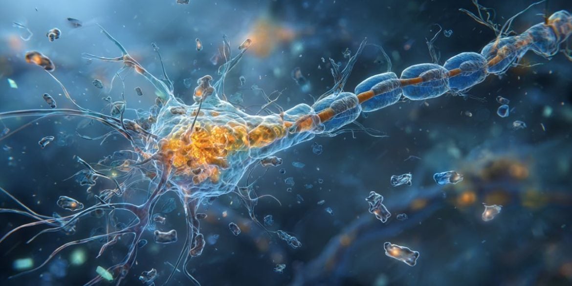This shows a neuron and plastic particles.