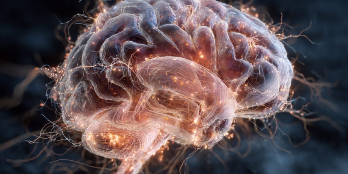 This shows a brain.