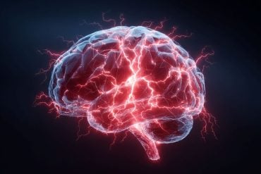 This shows a brain.