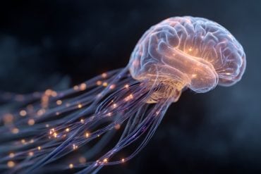 This shows a brain.