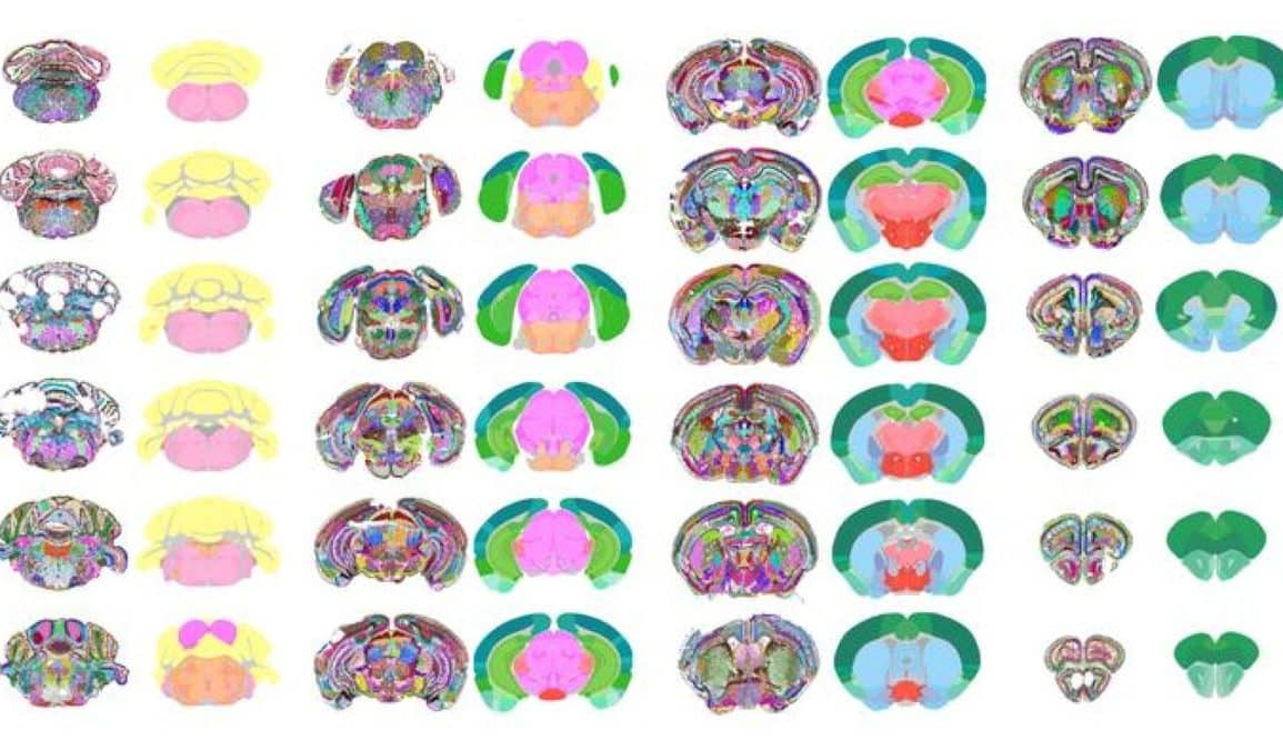 This shows different regions of the mouse brain, as produced by the AI.