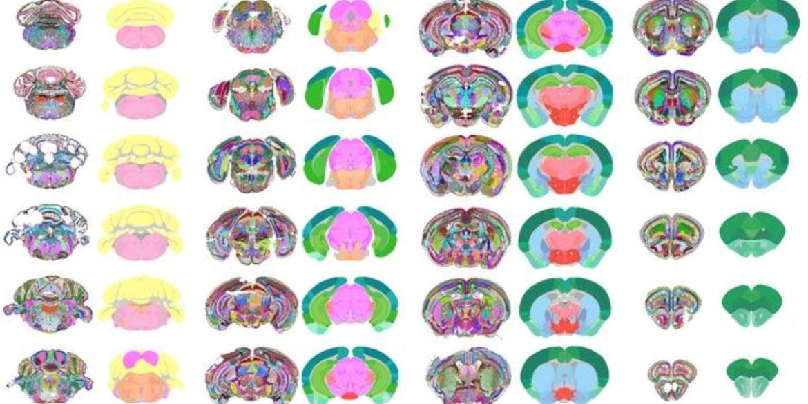 This shows different regions of the mouse brain, as produced by the AI.