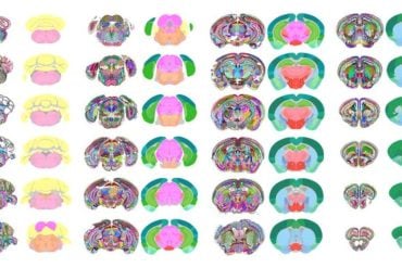 This shows different regions of the mouse brain, as produced by the AI.