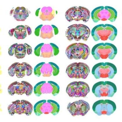 This shows different regions of the mouse brain, as produced by the AI.