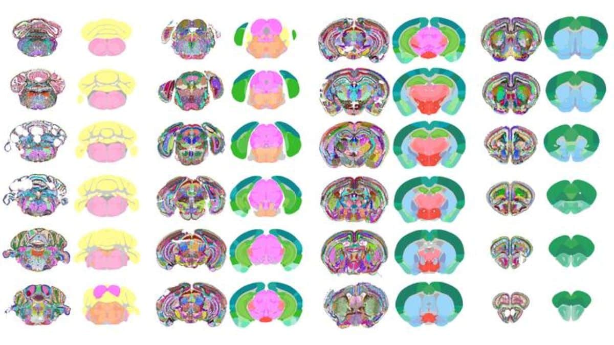 This shows different regions of the mouse brain, as produced by the AI.