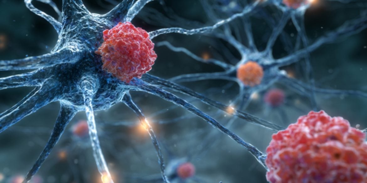 This shows neurons and immune cells.