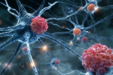 This shows neurons and immune cells.