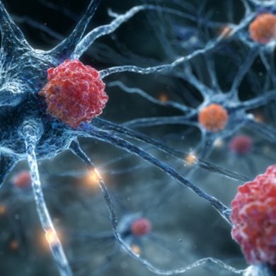 This shows neurons and immune cells.