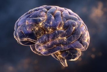 This shows a brain.