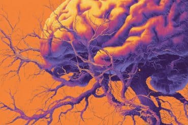 This shows a brain.