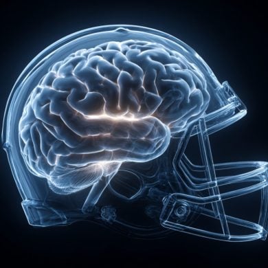This shows a brain in a helmet.