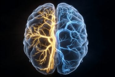 This shows a brain.