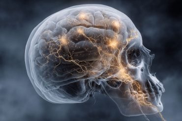 This shows a skull and a brain.