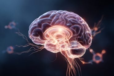 This shows a brain.