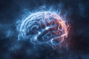 This shows a brain.