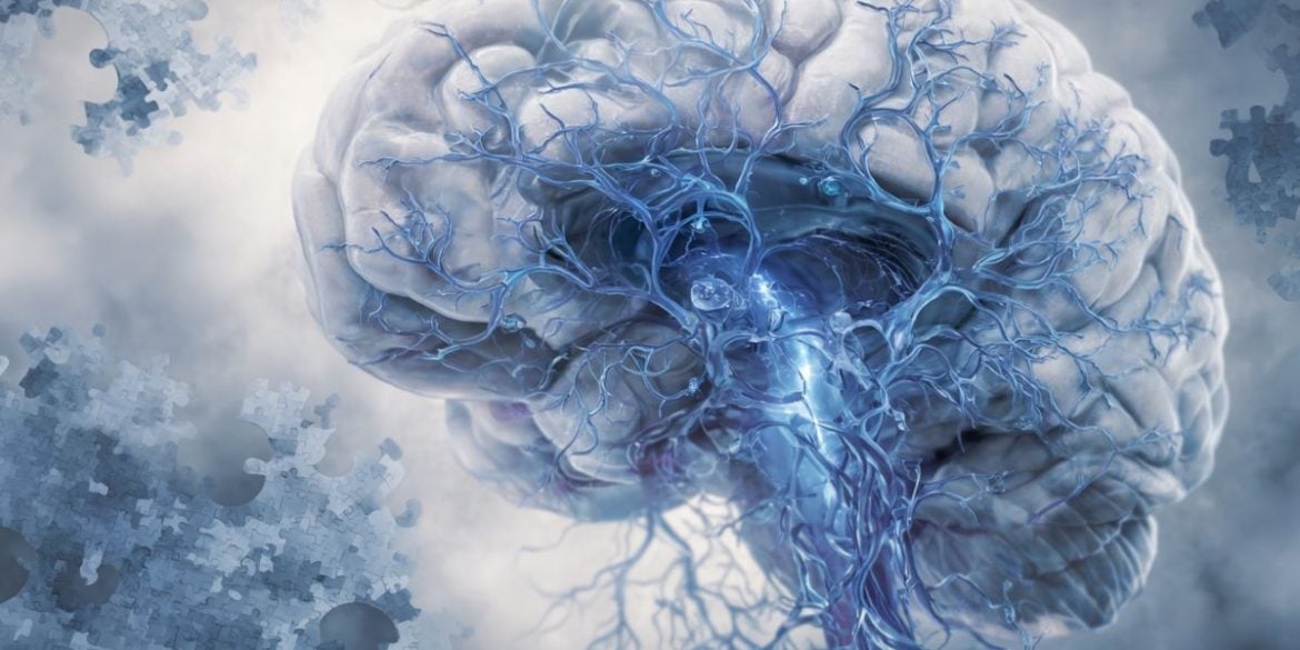 This shows a brain.