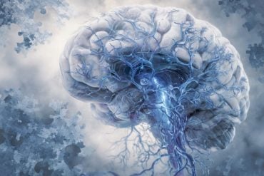 This shows a brain.