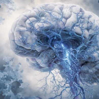 This shows a brain.