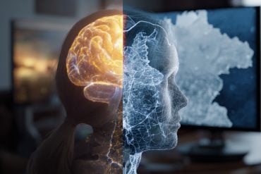 This shows a brain.