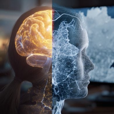 This shows a brain.