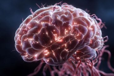 This shows a brain.