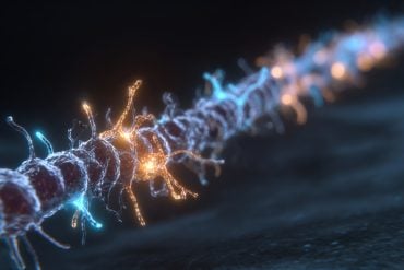 This shows a neuron.