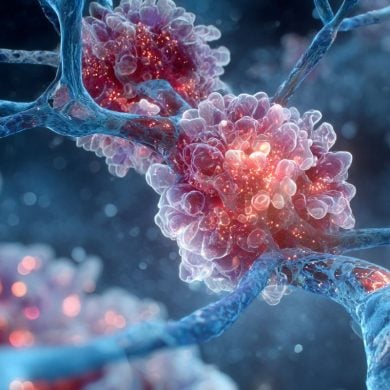 This shows a neuron.