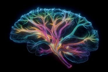 This shows a brain.
