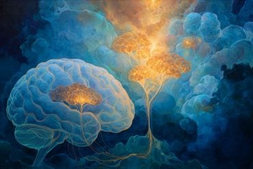 This shows a brain.