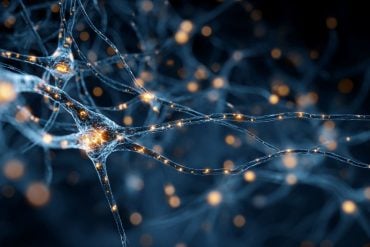 This shows neurons.