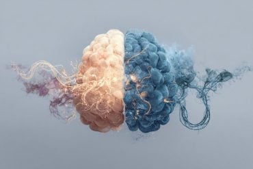 This shows a brain.