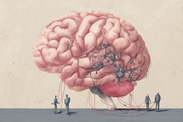 This shows a brain and electrodes.