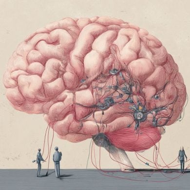 This shows a brain and electrodes.