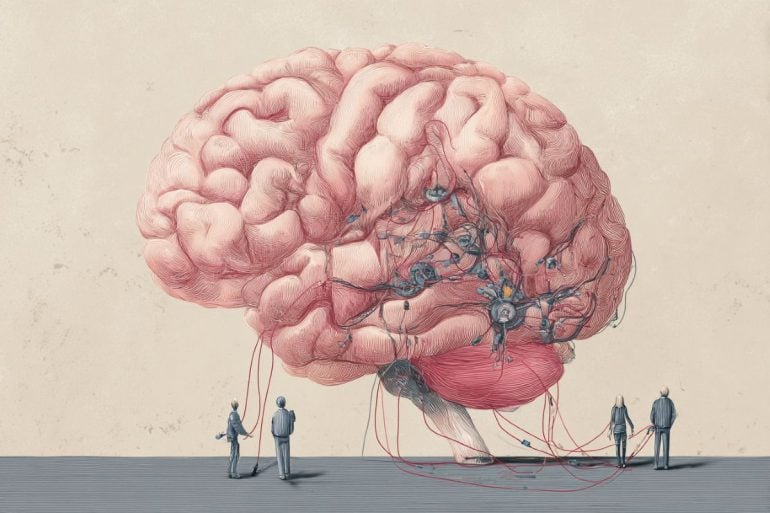 This shows a brain and electrodes.