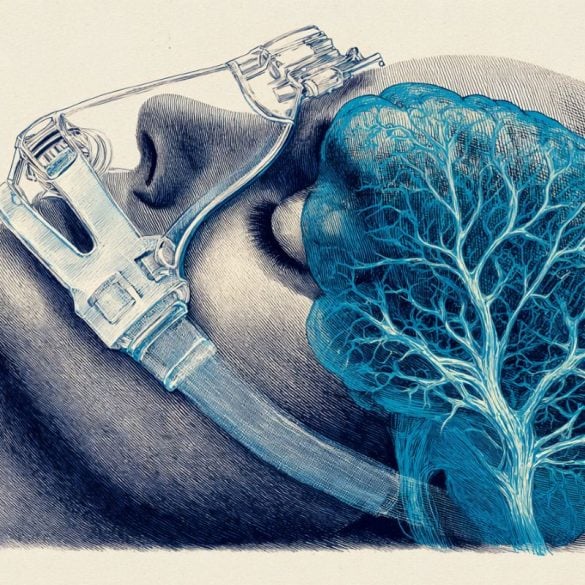 This shows a person sleeping with a CPAP machine on and a brain.