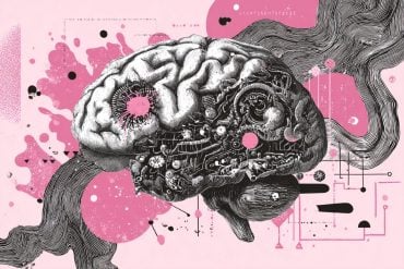 This shows a brain with computer components on it.